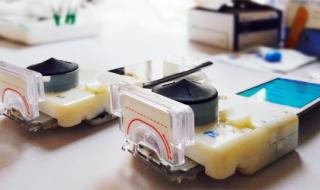 Smartphone dongles used to perform HIV and Syphilis diagnosis